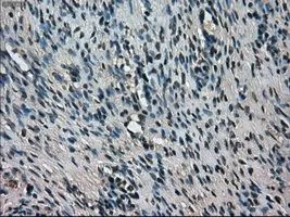IHC-P analysis of ovary tissue using GTX83509 TMEM100 antibody [2D3]. Antigen retrieval : Heat-induced epitope retrieval by 10mM citrate buffer, pH6.0, 100oC for 10min. Dilution : 1:50