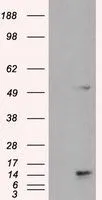 WB analysis of HEK293T cells transfected with TMEM100 plasmid (Right) or empty vector (Left) for 48 hrs using GTX83509 TMEM100 antibody [2D3]. Loading : 5 ug per lane