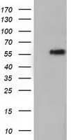 WB analysis of HEK293T cells transfected with TCP11L2 plasmid (Right) or empty vector (Left) for 48 hrs using GTX83518 TCP11L2 antibody [2A10]. Loading : 5 ug per lane