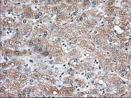 IHC-P analysis of human liver tissue using GTX83523 TXA synthase antibody [2C1]. Antigen retrieval : Heat-induced epitope retrieval by 10mM citrate buffer, pH6.0, 100oC for 10min. Dilution : 1:50
