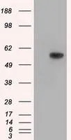 WB analysis of HEK293T cells transfected with TXA synthase plasmid (Right) or empty vector (Left) for 48 hrs using GTX83523 TXA synthase antibody [2C1]. Loading : 5 ug per lane