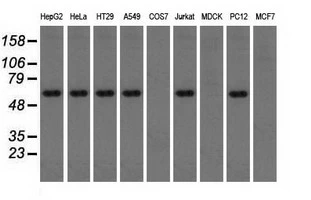 WB analysis of various cell lines using GTX83523 TXA synthase antibody [2C1]. Loading : 35 ug per lane