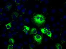 ICC/IF analysis of COS7 cells transiently transfected with TXA synthase plasmid using GTX83523 TXA synthase antibody [2C1].