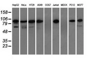 WB analysis of various cell lines using GTX83529 TACC3 antibody [1E11]. Loading : 35 ug per lane