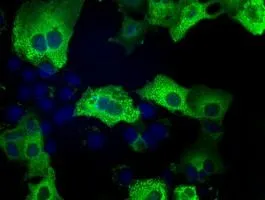 ICC/IF analysis of COS7 cells transiently transfected with TACC3 plasmid using GTX83529 TACC3 antibody [1E11].