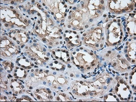 IHC-P analysis of human kidney tissue using GTX83533 TACC3 antibody [7B11]. Antigen retrieval : Heat-induced epitope retrieval by 10mM citrate buffer, pH6.0, 100oC for 10min. Dilution : 1:50