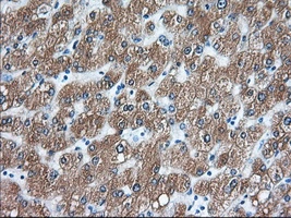 IHC-P analysis of human liver tissue using GTX83533 TACC3 antibody [7B11]. Antigen retrieval : Heat-induced epitope retrieval by 10mM citrate buffer, pH6.0, 100oC for 10min. Dilution : 1:50