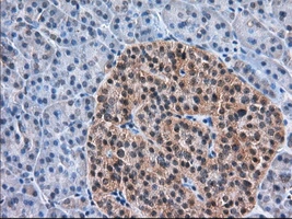 IHC-P analysis of human pancreas tissue using GTX83533 TACC3 antibody [7B11]. Antigen retrieval : Heat-induced epitope retrieval by 10mM citrate buffer, pH6.0, 100oC for 10min. Dilution : 1:50
