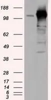 WB analysis of HEK293T cells transfected with TACC3 plasmid (Right) or empty vector (Left) for 48 hrs using GTX83533 TACC3 antibody [7B11]. Loading : 5 ug per lane