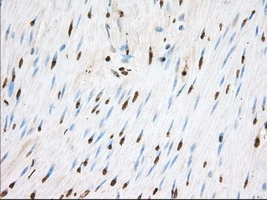 IHC-P analysis of human colon tissue using GTX83534 TACC3 antibody [8F6]. Antigen retrieval : Heat-induced epitope retrieval by 10mM citrate buffer, pH6.0, 100oC for 10min. Dilution : 1:50