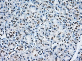 IHC-P analysis of human pancreas tissue using GTX83534 TACC3 antibody [8F6]. Antigen retrieval : Heat-induced epitope retrieval by 10mM citrate buffer, pH6.0, 100oC for 10min. Dilution : 1:50