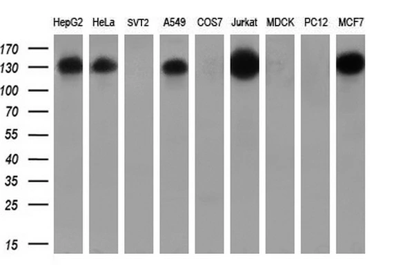 WB analysis of various cell lines using GTX83534 TACC3 antibody [8F6]. Loading : 35 ug per lane Dilution : 1:200