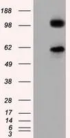 WB analysis of HEK293T cells transfected with TACC3 plasmid (Right) or empty vector (Left) for 48 hrs using GTX83534 TACC3 antibody [8F6]. Loading : 5 ug per lane