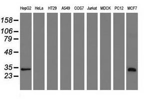 WB analysis of various cell lines using GTX83536 SULT2A1 antibody [3G4]. Loading : 35 ug per lane