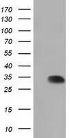WB analysis of HEK293T cells transfected with SULT2A1 plasmid (Right) or empty vector (Left) for 48 hrs using GTX83540 SULT2A1 antibody [7G10]. Loading : 5 ug per lane