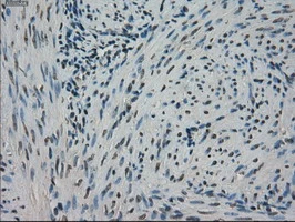 IHC-P analysis of human endometrium tissue using GTX83541 STK39 antibody [3C12]. Antigen retrieval : Heat-induced epitope retrieval by 10mM citrate buffer, pH6.0, 100oC for 10min.