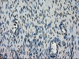 IHC-P analysis of human ovary tissue using GTX83541 STK39 antibody [3C12]. Antigen retrieval : Heat-induced epitope retrieval by 10mM citrate buffer, pH6.0, 100oC for 10min.