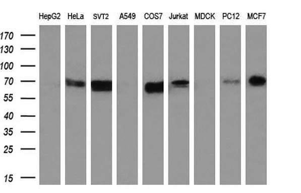 WB analysis of various cell lines using GTX83541 STK39 antibody [3C12]. Loading : 35 ug per lane Dilution : 1:200