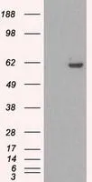 WB analysis of HEK293T cells transfected with STK39 plasmid (Right) or empty vector (Left) for 48 hrs using GTX83541 STK39 antibody [3C12]. Loading : 5 ug per lane