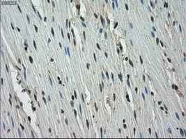 IHC-P analysis of colon tissue using GTX83543 STK39 antibody [2E10]. Antigen retrieval : Heat-induced epitope retrieval by 10mM citrate buffer, pH6.0, 100oC for 10min. Dilution : 1:50