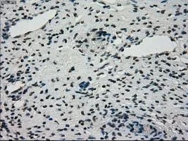 IHC-P analysis of ovary tissue using GTX83543 STK39 antibody [2E10]. Antigen retrieval : Heat-induced epitope retrieval by 10mM citrate buffer, pH6.0, 100oC for 10min. Dilution : 1:50