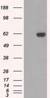 WB analysis of HEK293T cells transfected with STK39 plasmid (Right) or empty vector (Left) for 48 hrs using GTX83543 STK39 antibody [2E10]. Loading : 5 ug per lane