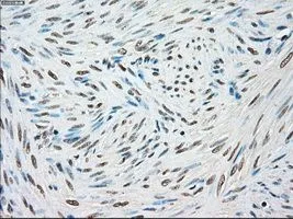 IHC-P analysis of endometrium tissue using GTX83546 STK3 antibody [4G10]. Antigen retrieval : Heat-induced epitope retrieval by 10mM citrate buffer, pH6.0, 100oC for 10min. Dilution : 1:50