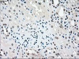 IHC-P analysis of kidney tissue using GTX83546 STK3 antibody [4G10]. Antigen retrieval : Heat-induced epitope retrieval by 10mM citrate buffer, pH6.0, 100oC for 10min. Dilution : 1:50