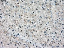 IHC-P analysis of liver tissue using GTX83546 STK3 antibody [4G10]. Antigen retrieval : Heat-induced epitope retrieval by 10mM citrate buffer, pH6.0, 100oC for 10min. Dilution : 1:50