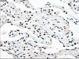 IHC-P analysis of lung tissue using GTX83546 STK3 antibody [4G10]. Antigen retrieval : Heat-induced epitope retrieval by 10mM citrate buffer, pH6.0, 100oC for 10min. Dilution : 1:50