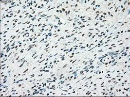 IHC-P analysis of ovary tissue using GTX83546 STK3 antibody [4G10]. Antigen retrieval : Heat-induced epitope retrieval by 10mM citrate buffer, pH6.0, 100oC for 10min. Dilution : 1:50