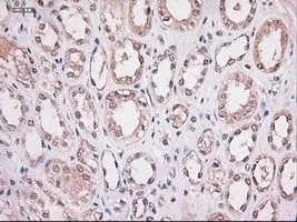 IHC-P analysis of kidney tissue using GTX83548 STAT4 antibody [2A2]. Antigen retrieval : Heat-induced epitope retrieval by 10mM citrate buffer, pH6.0, 100oC for 10min.