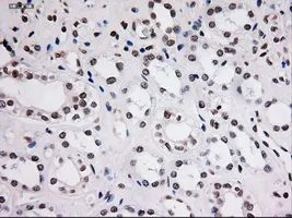 IHC-P analysis of kidney tissue using GTX83549 STAT3 antibody [21E7]. Antigen retrieval : Heat-induced epitope retrieval by 10mM citrate buffer, pH6.0, 100oC for 10min. Dilution : 1:150