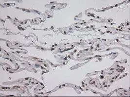 IHC-P analysis of lung tissue using GTX83549 STAT3 antibody [21E7]. Antigen retrieval : Heat-induced epitope retrieval by 10mM citrate buffer, pH6.0, 100oC for 10min. Dilution : 1:150