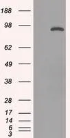 WB analysis of HEK293T cells transfected with STAT1 plasmid (Right) or empty vector (Left) for 48 hrs using GTX83550 STAT1 antibody [15H3]. Loading : 5 ug per lane