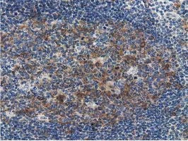 IHC-P analysis of human lymph node tissue using GTX83556 SSSCA1 antibody [2F5].