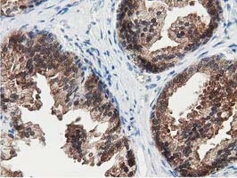 IHC-P analysis of human prostate tissue using GTX83556 SSSCA1 antibody [2F5].
