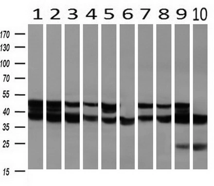 WB analysis of human tissues (Lane 1-Testis ; Lane 2-Omentum ; Lane 3-Uterus ; Lane 4-Breast ; Lane 5-Brain ; Lane 6-Liver ; Lane 7-Ovary ; Lane 8-Thyroid gland ; Lane 9-colon ; Lane 10-spleen) using GTX83558 SSB antibody [1E11]. Loading : 10 ug per lane Dilution : 1:1000