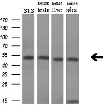 WB analysis of various samples using GTX83558 SSB antibody [1E11]. Loading : 10 ug per lane Dilution : 1:200