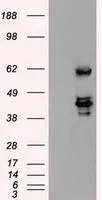 WB analysis of HEK293T cells transfected with SSB plasmid (Right) or empty vector (Left) for 48 hrs using GTX83558 SSB antibody [1E11]. Loading : 5 ug per lane