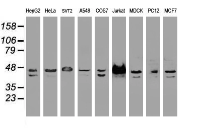 WB analysis of various cell lines using GTX83558 SSB antibody [1E11]. Loading : 35 ug per lane
