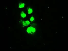ICC/IF analysis of COS7 cells transiently transfected with SSB plasmid using GTX83558 SSB antibody [1E11].