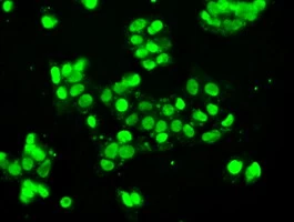 ICC/IF analysis of HepG2 cells using GTX83558 SSB antibody [1E11].
