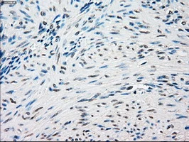 IHC-P analysis of human endometrium tissue using GTX83560 SSB antibody [3H9]. Antigen retrieval : Heat-induced epitope retrieval by 10mM citrate buffer, pH6.0, 100oC for 10min.
