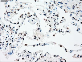IHC-P analysis of human lung tissue using GTX83560 SSB antibody [3H9]. Antigen retrieval : Heat-induced epitope retrieval by 10mM citrate buffer, pH6.0, 100oC for 10min.