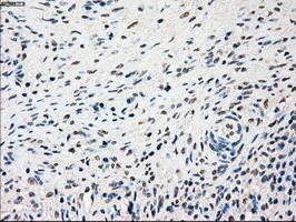 IHC-P analysis of human ovary tissue using GTX83560 SSB antibody [3H9]. Antigen retrieval : Heat-induced epitope retrieval by 10mM citrate buffer, pH6.0, 100oC for 10min.