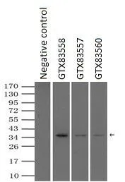 IP analysis of DDDDK tagged SSB overexpressed HEK293T lysate using GTX83560 SSB antibody [3H9].After extensive wash to remove any non-specific binding, the immuno-precipitated products were analyzed with rabbit anti-DDDDK polyclonal antibody. IP reaction : 2microg antibody / 500microl cell lysate