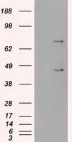 WB analysis of HEK293T cells transfected with SSB plasmid (Right) or empty vector (Left) for 48 hrs using GTX83560 SSB antibody [3H9]. Loading : 5 ug per lane