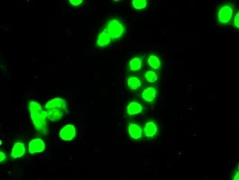 ICC/IF analysis of HT29 cells using GTX83560 SSB antibody [3H9].