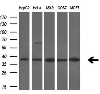 WB analysis of various cell lines using GTX83568 Serine racemase antibody [7E8]. Loading : 10 ug per lane Dilution : 1:200